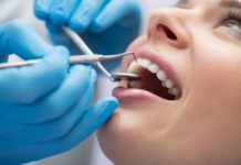 Transforming Smiles Worldwide: Innovative Approaches to Oral Healthcare