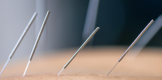 How Does Dry Needling Therapy Help Reduce Muscle Tension?