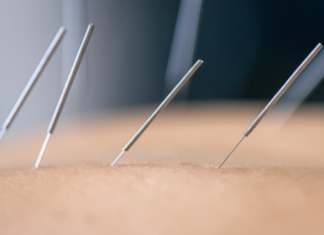 How Does Dry Needling Therapy Help Reduce Muscle Tension?