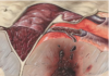 Healing with Expert Support: How a Colon Surgery Doctor Can Help You on Your Recovery Journey