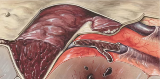 Healing with Expert Support: How a Colon Surgery Doctor Can Help You on Your Recovery Journey