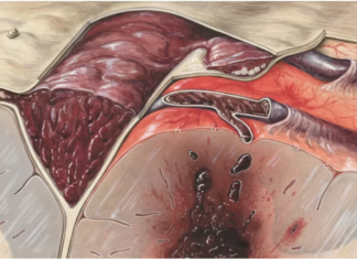 Healing with Expert Support: How a Colon Surgery Doctor Can Help You on Your Recovery Journey