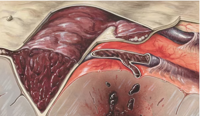 Healing with Expert Support: How a Colon Surgery Doctor Can Help You on Your Recovery Journey