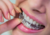 Proven Tips and Modern Solutions to Improve Your Smile