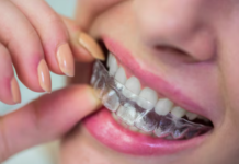 Proven Tips and Modern Solutions to Improve Your Smile