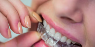 Proven Tips and Modern Solutions to Improve Your Smile